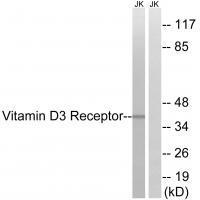 Rabbit Polyclonal Antibody to Vitamin D3 Receptor (Ab-51)