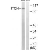 Rabbit Polyclonal Antibody to ITCH (Ab-420)