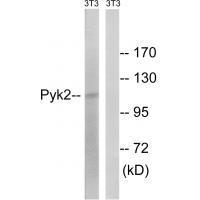 Rabbit Polyclonal Antibody to PYK2 (Ab-579)