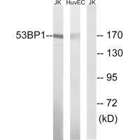 Rabbit Polyclonal Antibody to 53BP1 (Ab-29)