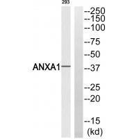 Rabbit Polyclonal Antibody to ANXA1 (Ab-21)
