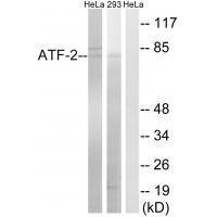 Rabbit Polyclonal Antibody to ATF-2 (Ab-472)
