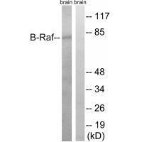 Rabbit Polyclonal Antibody to B-Raf (Ab-753)