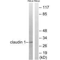 Rabbit Polyclonal Antibody to Claudin 1 (Ab-210)