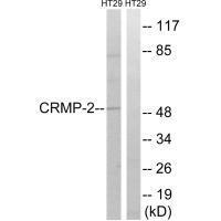 Rabbit Polyclonal Antibody to CRMP-2 (Ab-509)