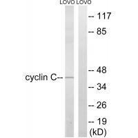 Rabbit Polyclonal Antibody to Cyclin C (Ab-275)