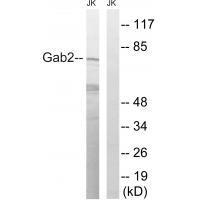 Rabbit Polyclonal Antibody to Gab2 (Ab-623)