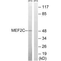 Rabbit Polyclonal Antibody to MEF2C (Ab-396)