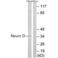 Rabbit Polyclonal Antibody to Neuro D (Ab-274)