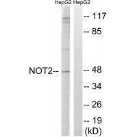 Rabbit Polyclonal Antibody to CNOT2 (Ab-101)