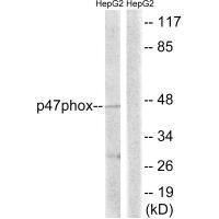 Rabbit Polyclonal Antibody to p47 phox (Ab-345)