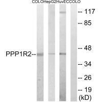 Rabbit Polyclonal Antibody to PPP1R2 (Ab-44)