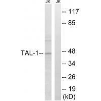 Rabbit Polyclonal Antibody to TAL-1 (Ab-122)