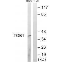 Rabbit Polyclonal Antibody to TOB1 (Ab-164)