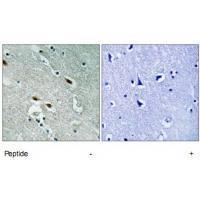 Rabbit Polyclonal Antibody to 53BP1