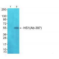 Rabbit Polyclonal Antibody to HS1 (Ab-397)