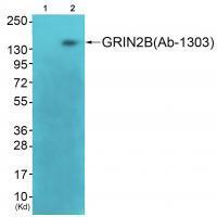 Rabbit Polyclonal Antibody to GRIN2B(Ab-1303)