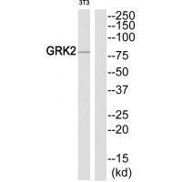 Rabbit Polyclonal Antibody to GRK2 (Ab-86)