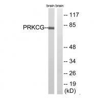 Rabbit Polyclonal Antibody to PRKCG(Ab-655)