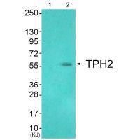 Rabbit Polyclonal Antibody to TPH2 (Ab-19)