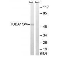 Rabbit Polyclonal Antibody to TUBA1/3/4 (Ab-272)