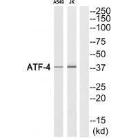 Rabbit Polyclonal Antibody to ATF-4 (Ab-219)