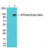 Rabbit Polyclonal Antibody to EPHA2/5 (Ab-594)