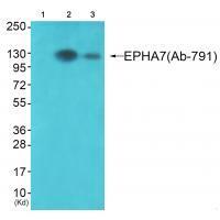Rabbit Polyclonal Antibody to EPHA7 (Ab-791)