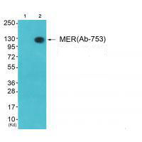 Rabbit Polyclonal Antibody to MER (Ab-753)