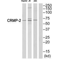 Rabbit Polyclonal Antibody to CRMP-2 (Ab-522)