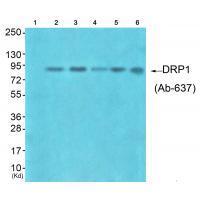 Rabbit Polyclonal Antibody to DRP1 (Ab-637)