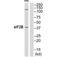 Rabbit Polyclonal Antibody to eIF2B (Ab-67)