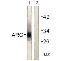Rabbit Polyclonal Antibody to ARC