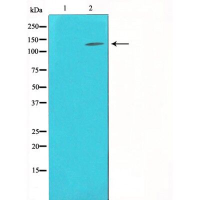 Rabbit Polyclonal Antibody to Collagen III