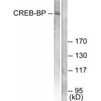 Rabbit Polyclonal Antibody to CREB-BP