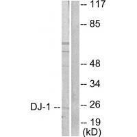 Rabbit Polyclonal Antibody to DJ-1