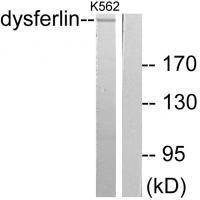 Rabbit Polyclonal Antibody to Dysferlin