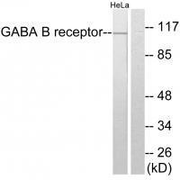 Rabbit Polyclonal Antibody to GABA B Receptor