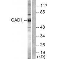 Rabbit Polyclonal Antibody to GAD1/2