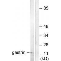 Rabbit Polyclonal Antibody to Gastrin