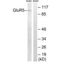 Rabbit Polyclonal Antibody to GluR5