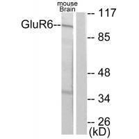 Rabbit Polyclonal Antibody to GluR6