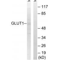 Rabbit Polyclonal Antibody to GLUT1