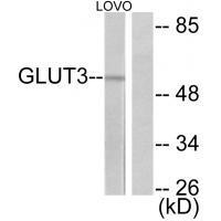 Rabbit Polyclonal Antibody to GLUT3