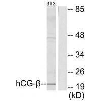 Rabbit Polyclonal Antibody to hCG β
