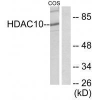 Rabbit Polyclonal Antibody to HDAC1