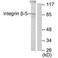 Rabbit Polyclonal Antibody to Integrin β5