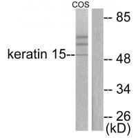 Rabbit Polyclonal Antibody to Keratin 15