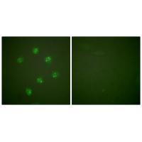 Rabbit Polyclonal Antibody to Ki67