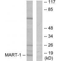 Rabbit Polyclonal Antibody to MART-1
